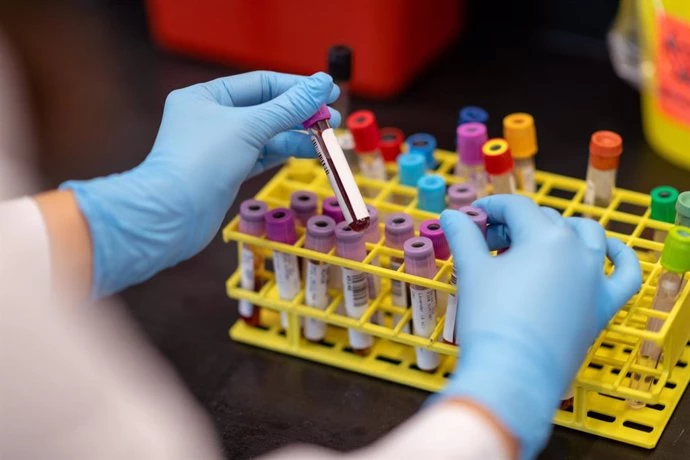 Biopsia liquida