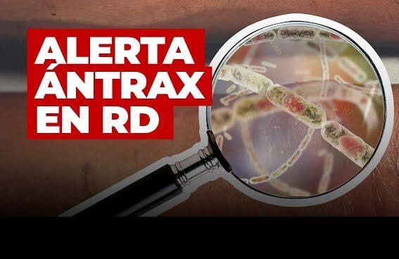 alerta antrax RD