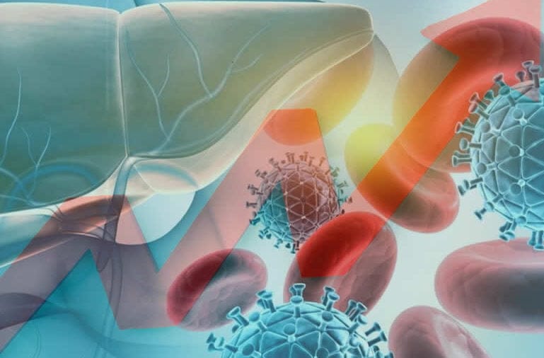 .hepatitis viral