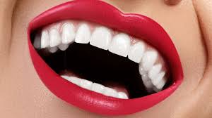 sonrisa