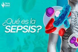 sepsis