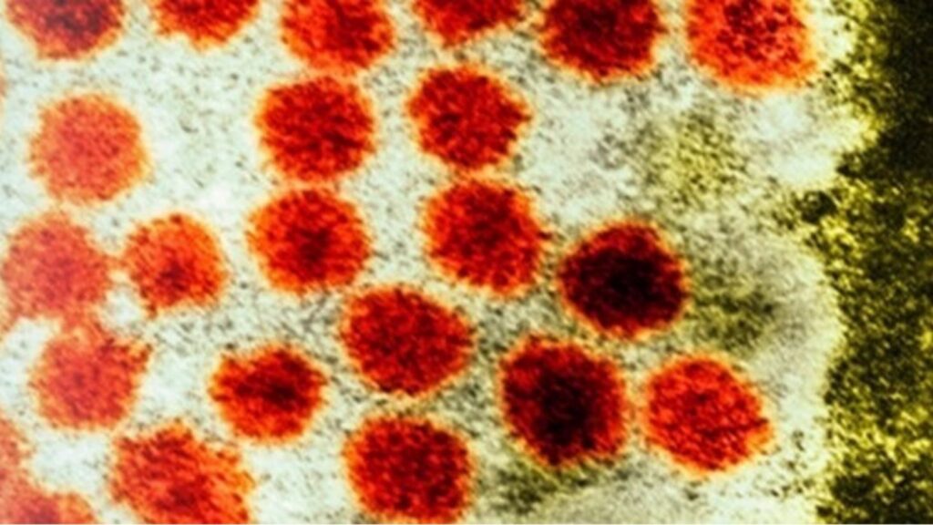 hepatitis