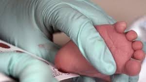 neonatal