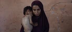 malnutricion gaza