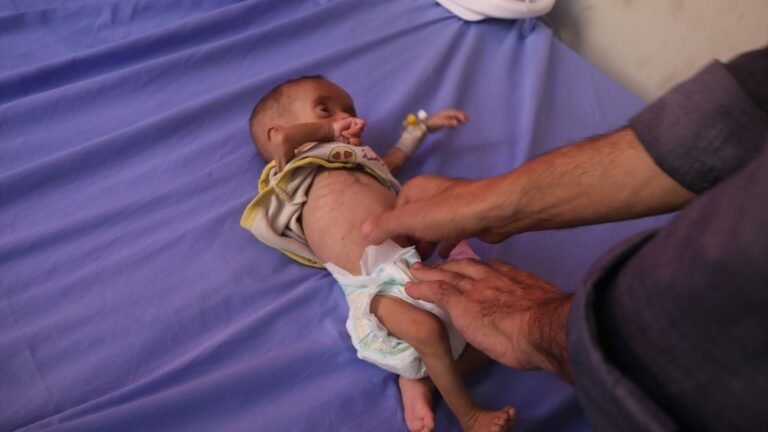 muerte por hambre en gaza