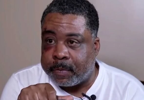 Hombre agredido por detectives en Brooklyn demanda al NYPD por 100 millones de dólares